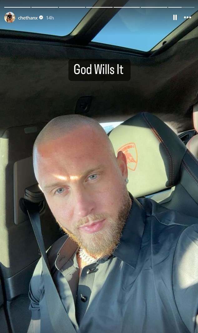 كما استعرض نجم تلفزيون الواقع نتائج علاجه التجميلي في صورتين متوهجتين، تم تحميلهما على حساباته على وسائل التواصل الاجتماعي.