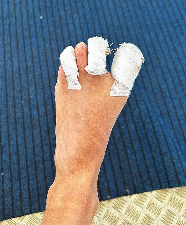 أشرك الممثل الكوميدي البالغ من العمر 42 عامًا جمهوره البالغ عددهم 803000 متابع عندما نشر تقريرًا إخباريًا ساخرًا عن قدمه