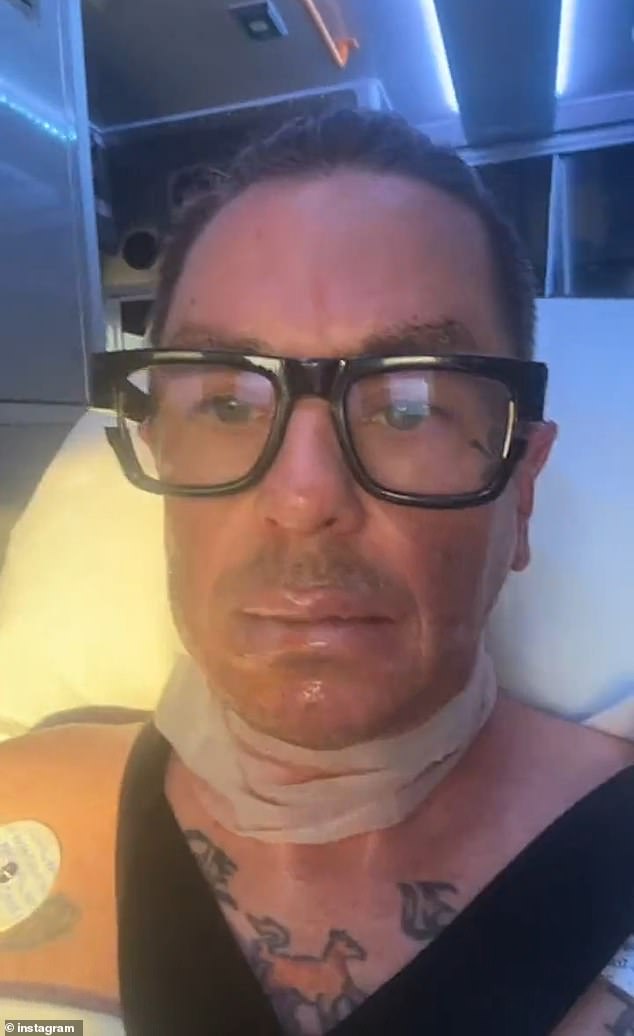 وأوضح أن الحادث وقع أثناء عمله في المزرعة وإشعال كومة من النيران وانفجرت النيران.