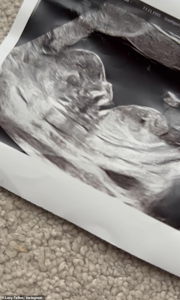 كان الزوجان جالسين مع سوني، ويمكن رؤيتهما وهما يقرآن كتابًا مع الطفل، قبل أن تنتقل الكاميرا إلى اختبار حمل إيجابي وفحص بالموجات فوق الصوتية.