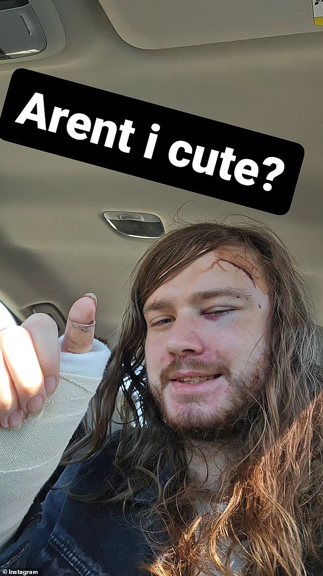 تم نقل شانس إلى المستشفى في أكتوبر 2023 بسبب جروح وكدمات مختلفة