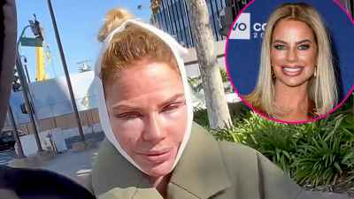 ربات البيوت الحقيقية جنونا صور ما بعد الجراحة