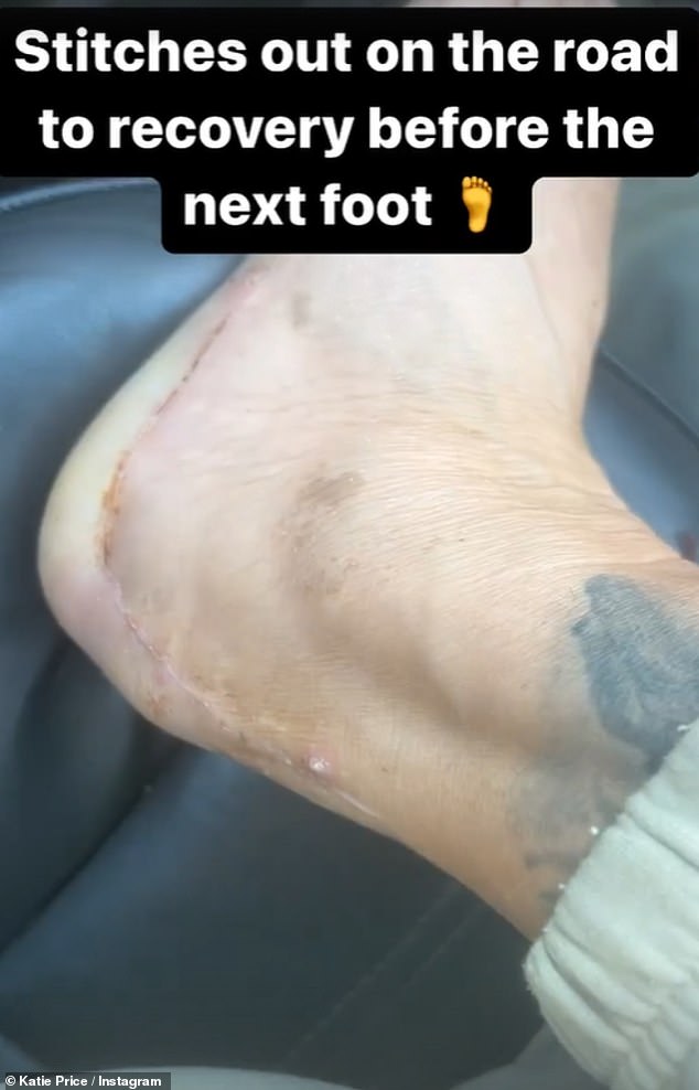 وفي تحديث لها في يناير من العام الماضي، شاركت صورة مروعة وقالت إنها الآن 