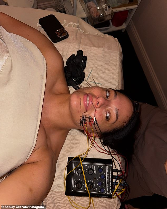 قامت عارضة IMG ذات الحجم الزائد - والتي بلغت 37 عامًا في 30 أكتوبر - بتجنيد مؤسسة Lanshin ساندرا لانشين تشيو لاستخدام تقنيات TCM / Gua Sha كبديل للبوتوكس