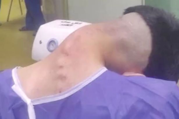 انخفض رأس الرجل إلى جانب واحد