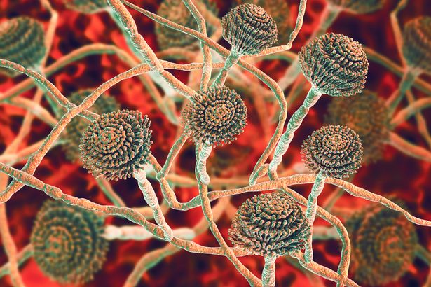 توضيح الكمبيوتر لأجسام الثمار (conidiophores)