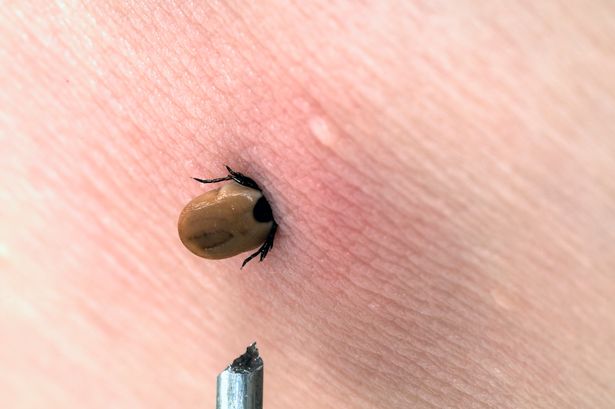 علامة كلب أنثى (rhipicephalus sanguineus) عالقة في الجلد الذراع لرجل في الصيف