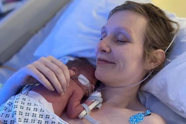 Kayleigh Walker مع "Miracle" Little Rosie Born by C Section