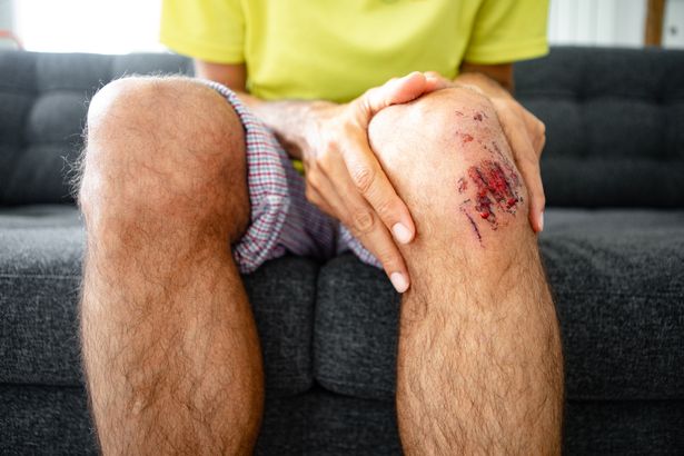 صورة مقربة لركبة رجل رعي