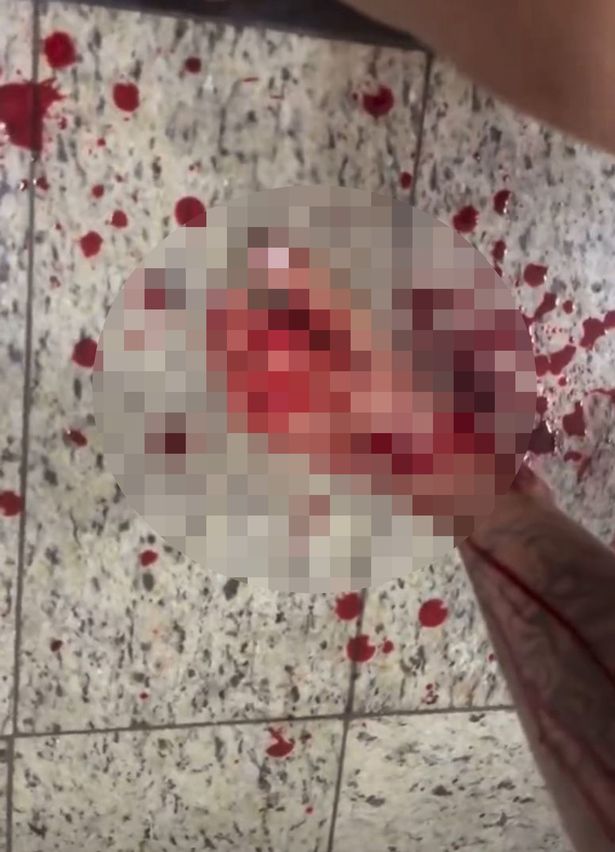 لونا أمبروزيفيسيوس أبراهاو