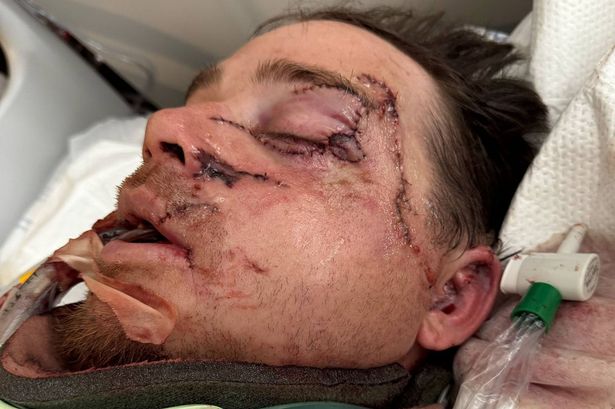 نجا جيسي باين بطريقة ما بعد سحق رأسه