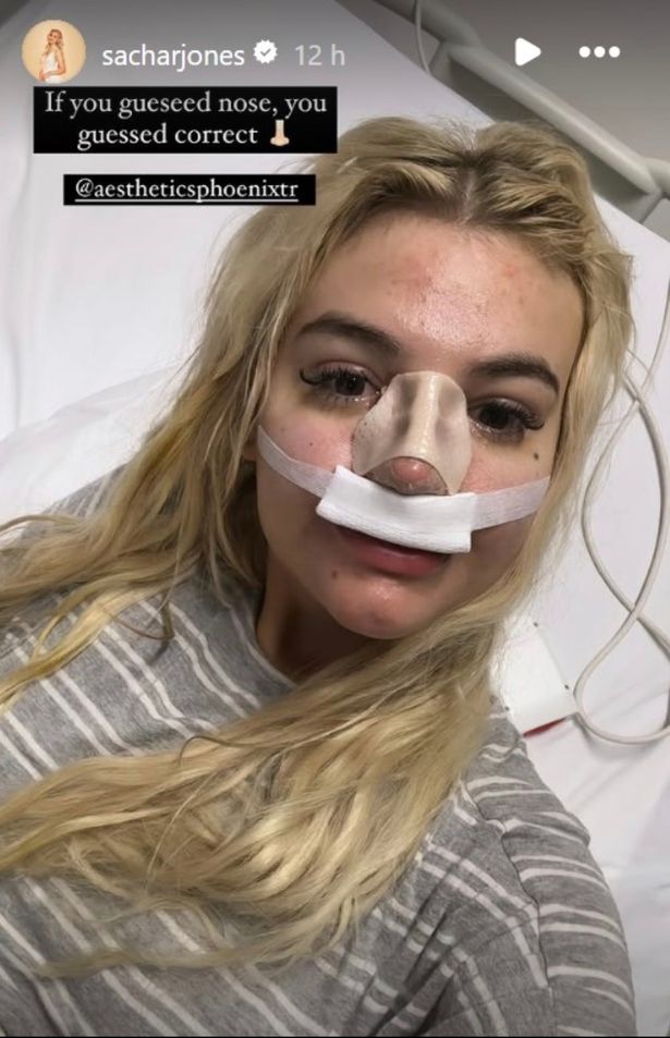 ساشا جونز مع أنفها ضمادة أثناء الاستلقاء على سرير المستشفى.
