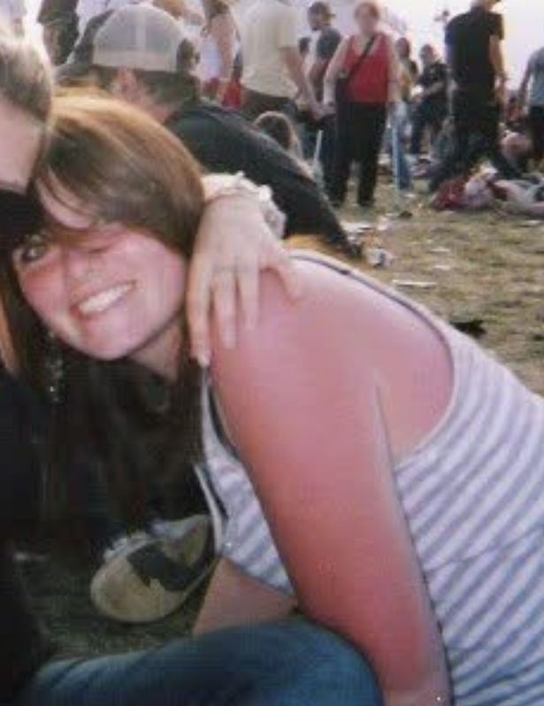 ميكايلا عندما كانت أصغر سنا - أحمر من حروق الشمس