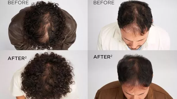 نتائج العملاء الذين يستخدمون العلاج مذهلة