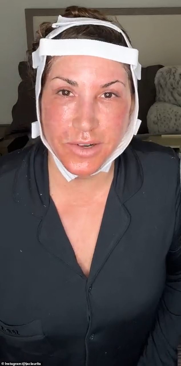 تلك السيدة هي ربات البيوت الحقيقيات لمحارب نيو جيرسي المخضرم جاكلين لوريتا. قالت جمال سمراء إنها كانت تتعافى من الحصول على عملية تجميل ورفع الرقبة. نشرت ربات البيوت الحقيقيات في نيو جيرسي مقطع فيديو عن نفسها كلها مصابة بتقديم كدمات وضمادت بعد عمليات تجميلها إلى Instagram يوم الاثنين