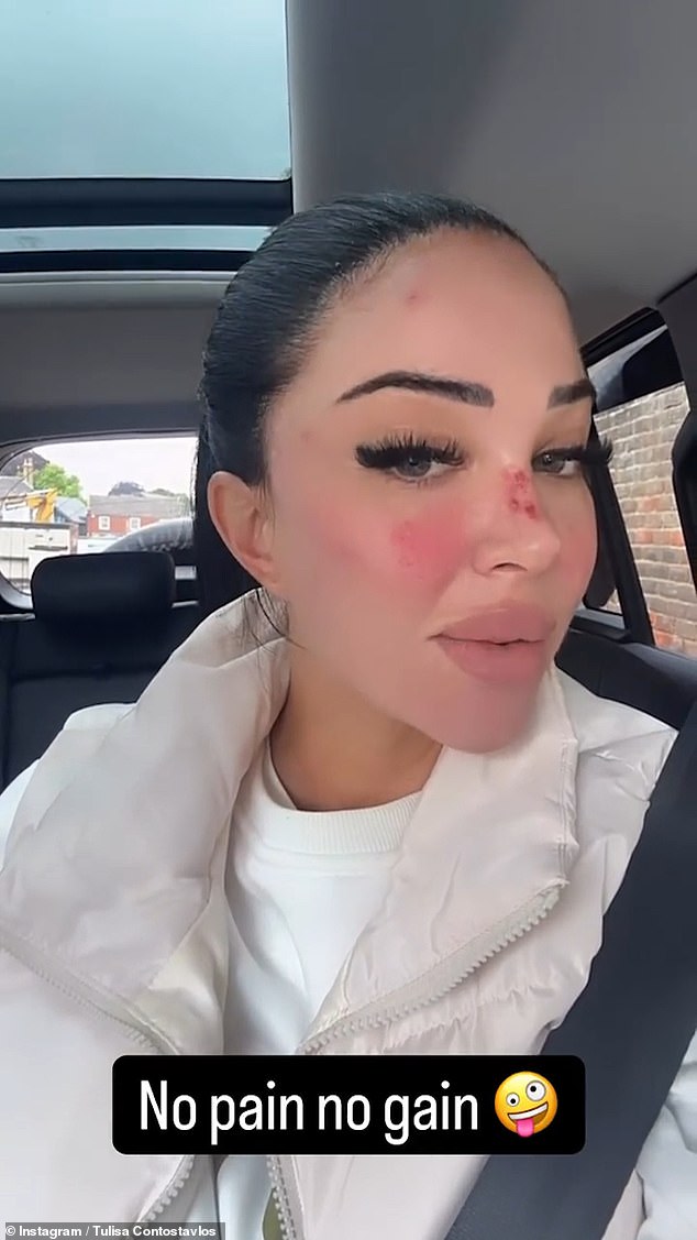 عرضت Tulisa نتائجها في يوم جمال الماراثون يوم الثلاثاء بعد الانتهاء من ستة علاجات تجميل متتالية