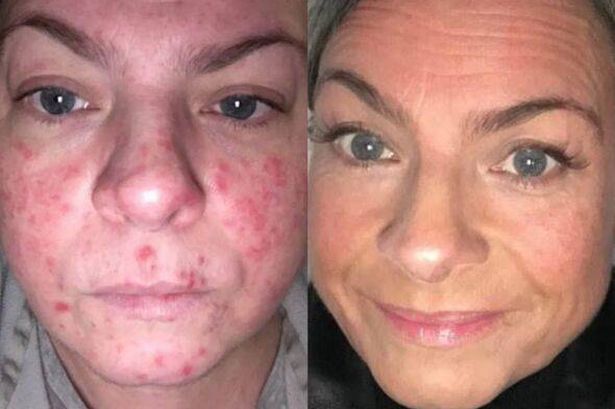 47SKIN SPF 30 قبل وبعد