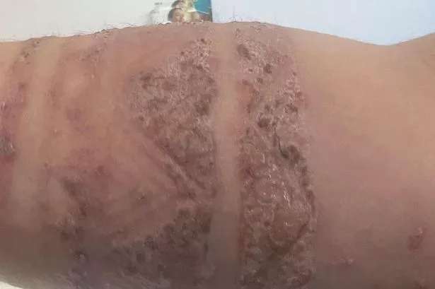 الحناء