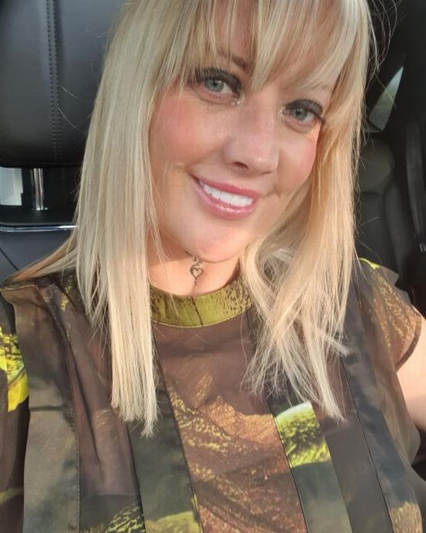 Leanne Abeyance قبل عمل الأسنان في تركيا