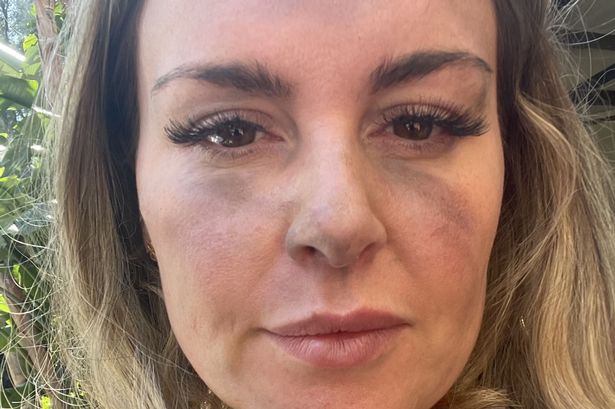 بيثاني والاس مع علامات الدخان على وجهها 