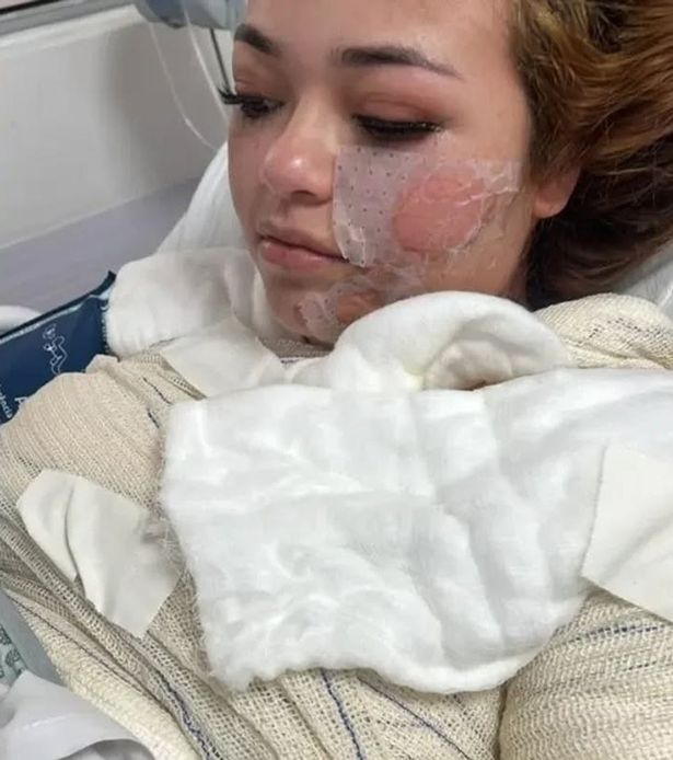 صورة لجابرييل في المستشفى 