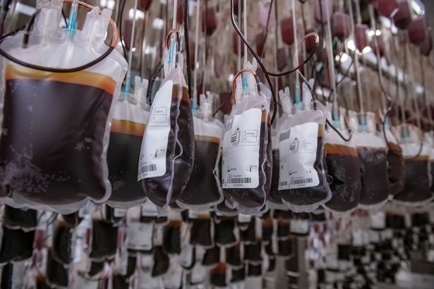 منطقة التصنيع في مركز NHSBT Blood Proccessing Center في فيلتون ، بريستول