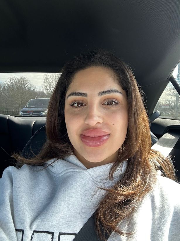 كيميا تصور مع شفتيها المتورمة