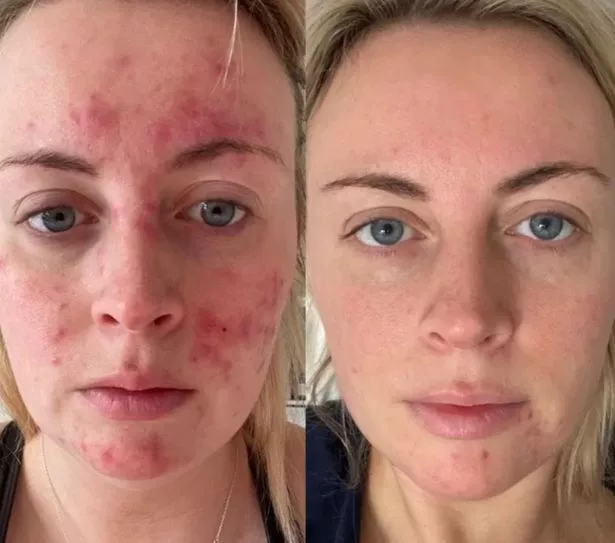 تساعد SPF 30 اليومية للجلد الـ 47 على الحفاظ على الشوائب في الخليج مع الحفاظ على الجلد محميًا من الشمس