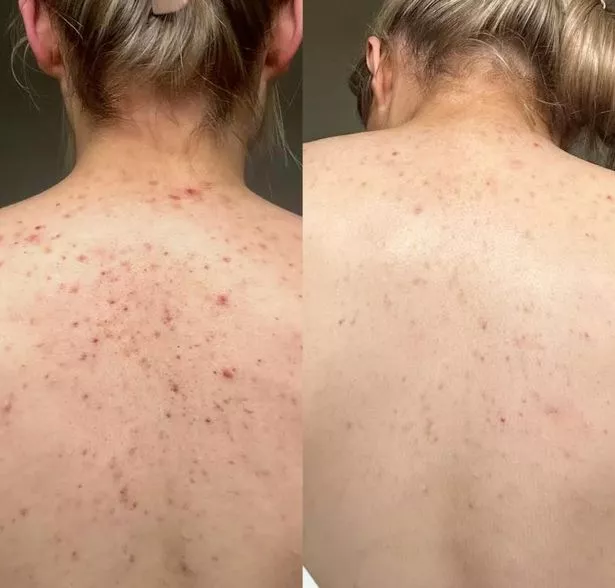 47 Skin's SPF Spray ليس فقط للوجوه لأنه يمكن استخدامه في جميع أنحاء الجسم ويساعد على الحفاظ على الجلد محميًا من الشمس بينما تساعد خصائصه المضادة للبكتيريا على إزالة البشرة 