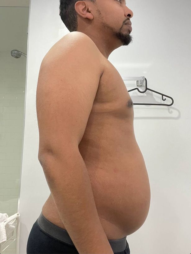 يقول أديب إن عائلته تعتقد أنه بدا أكثر صحة قبل فقدان وزنه