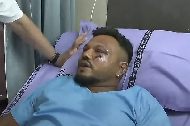   تزور ناريندرا مودي فيشواش راميش في المستشفى