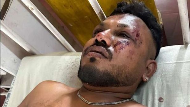 كان فيشواش راميش الناجي الوحيد