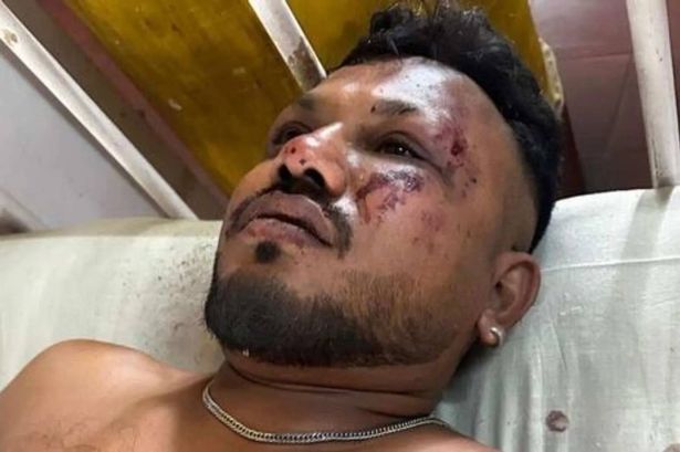 فيشواش كومار راميش يرقد على سرير في المستشفى بجروح