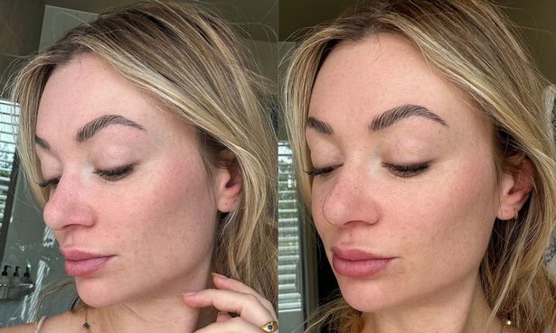 اليسار ، زوي مع عدم وجود أساس أو SPF ، يمينًا ، يرتدي فقط Supergoop!