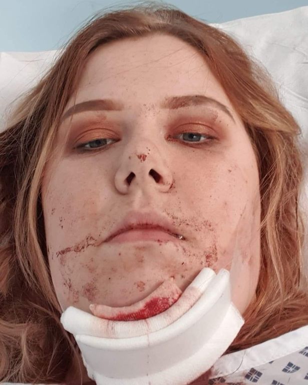 Jade Harrison بعد حادث أرض المعارض