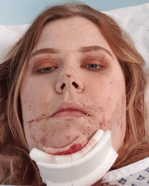 Jade Harrison بعد حادث أرض المعارض في أكتوبر 2019