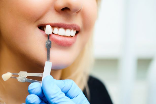 ألبوم صورة امرأة شابة. مطابقة ظلال عمليات الزرع أو عملية تبييض الأسنان