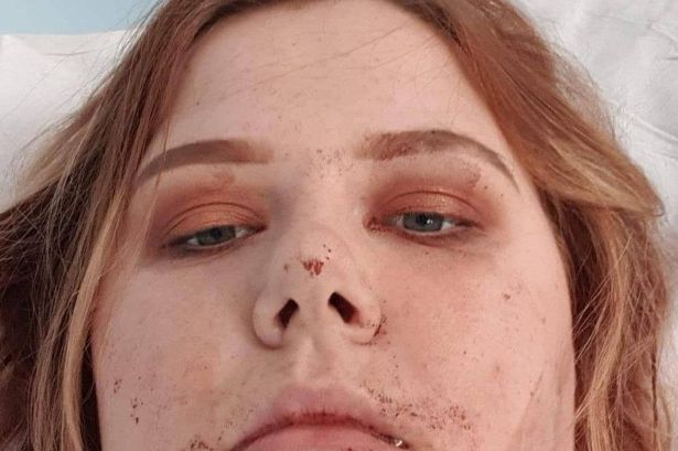 Jade Harrison بعد حادث أرض المعارض في أكتوبر 2019