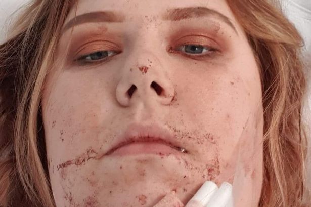 Jade Harrison بعد حادث أرض المعارض