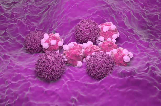 خلايا سرطان عنق الرحم