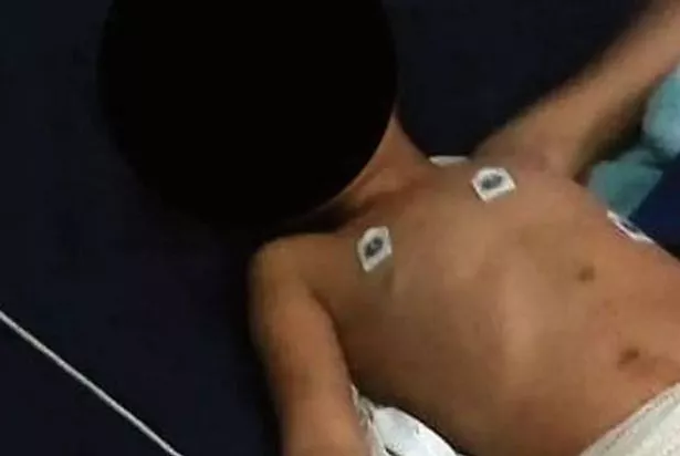 الضحية ، البالغة من العمر 6 سنوات ، في سيارة إسعاف بعد أن قطعت أعضائه التناسلية عندما تعرضت للهجوم في بلدة جنوب إفريقيا تسمى Blue Sky