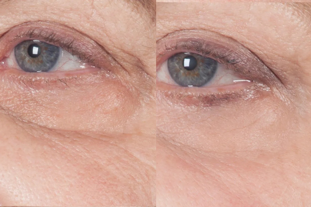 قبل وبعد استخدام كريم Elizabeth Grant Eye Cream