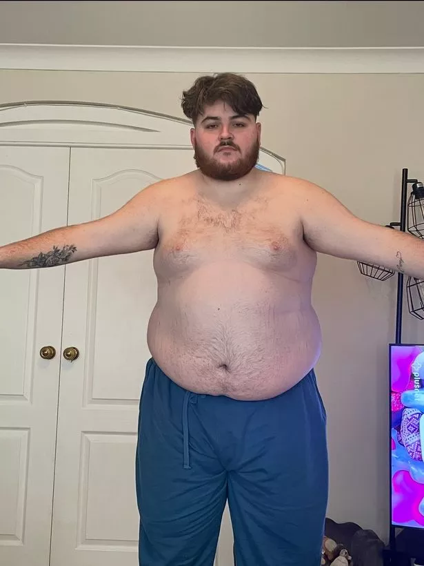 براندون جي قبل فقدان الوزن