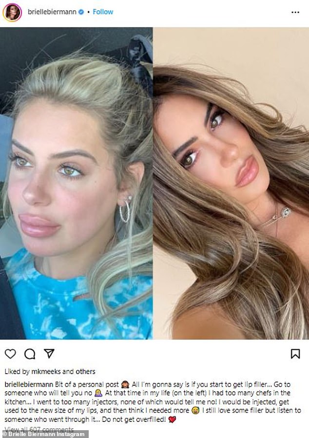في عام 2023 ، شاركت Brielle في صورة قبل وبعد صورة تقارن شفاهها المفرطة في 2019 معها لا تزال ممتلئة بالشفاه ولكن أكثر من شفاه طبيعية في ذلك الوقت. حذرت أي من المعجبين الذين أرادوا حشوات الشفاه