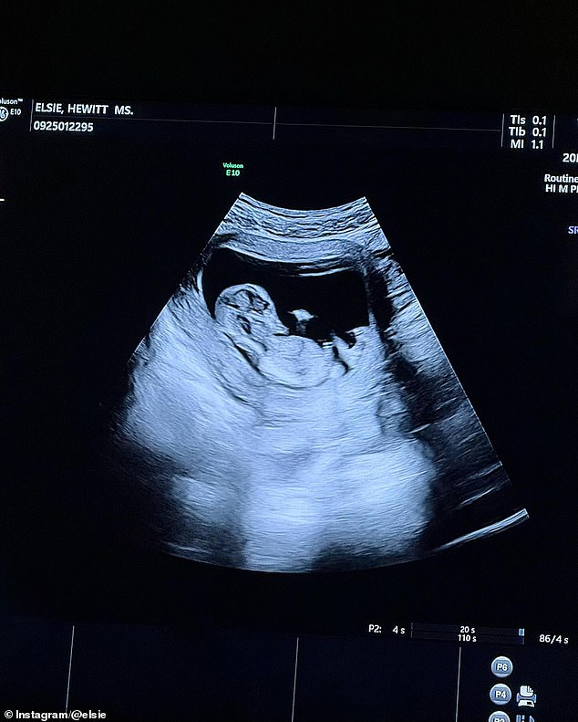 أظهرت صور أخرى أن الزوجين يرتدون ملابس بيضاء يحتفلان بالحمل ، وفحص لطفلهما الذي لم يولد بعد وحضور موعد بالموجات فوق الصوتية