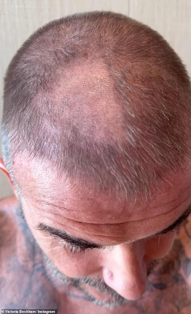 جاء بيكهام محصوراً بعد أن سقط رأسه من كليبرز في منتصف الحلق - تاركًا له رقعة أصلع صارخ على رأس رأسه