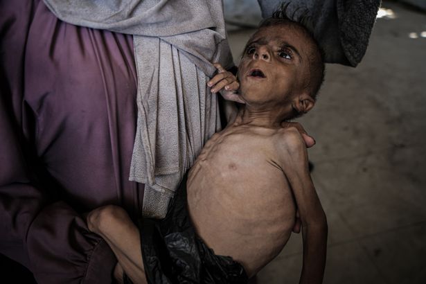في غزة يموت الأطفال من الجوع
