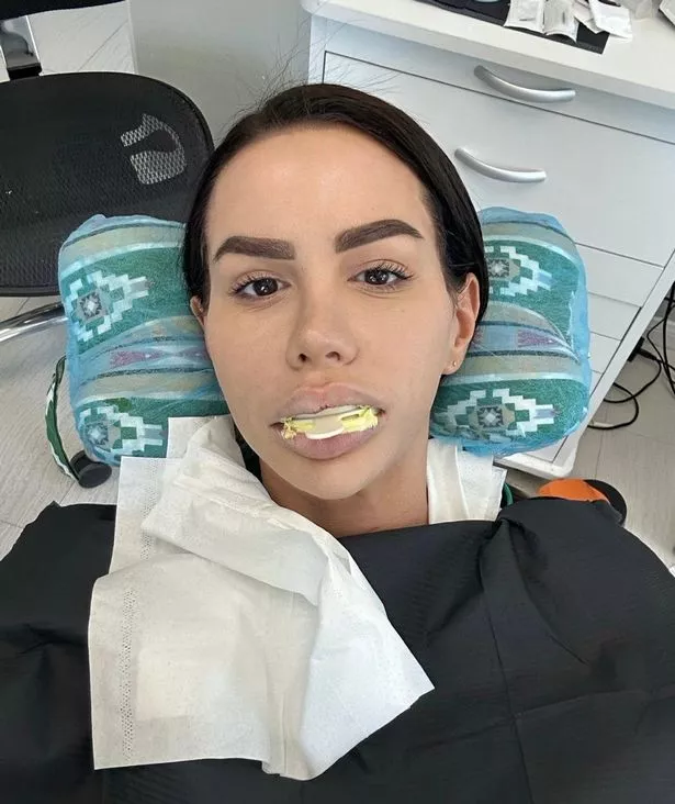 المرأة البالغة من العمر 30 عامًا ، من فلوريدا ، مصورة بعد جراحة الفك