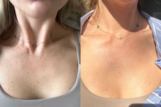يحاول رئيس الجمال لدينا واختباراته واكتشاف أفضل الطرق لإعطاء رقبتك وديسمبر لمكافحة الشيخوخة