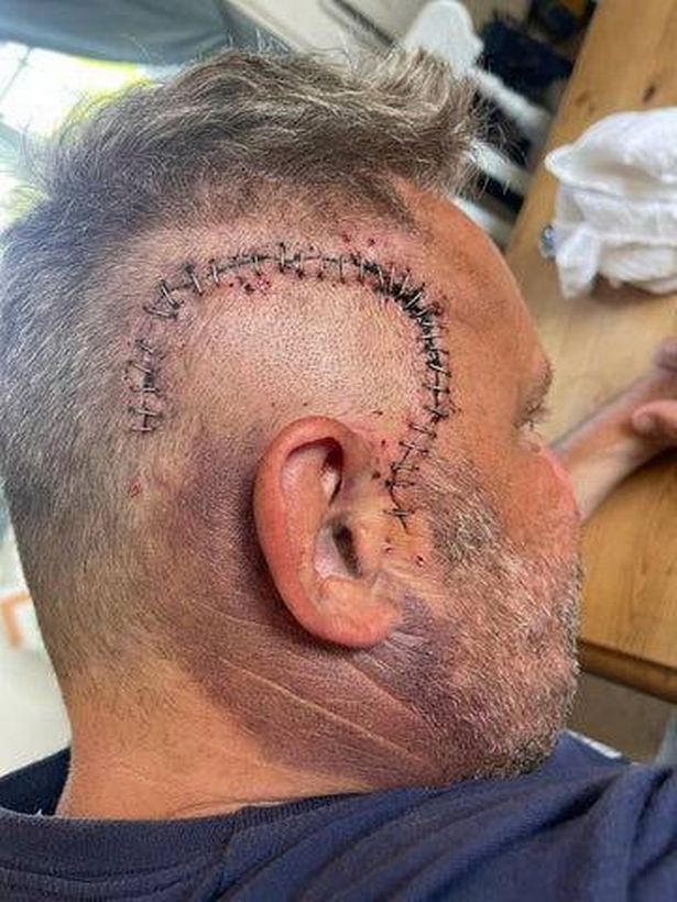 توفي آندي هامبتون بعد أن تركه ورم في الدماغ مقتنعًا بأن زوجته كانت تعاني من علاقة غرامية
